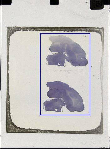 Media type: image; Special Collections 3043   shows specimen_part histological serial section;